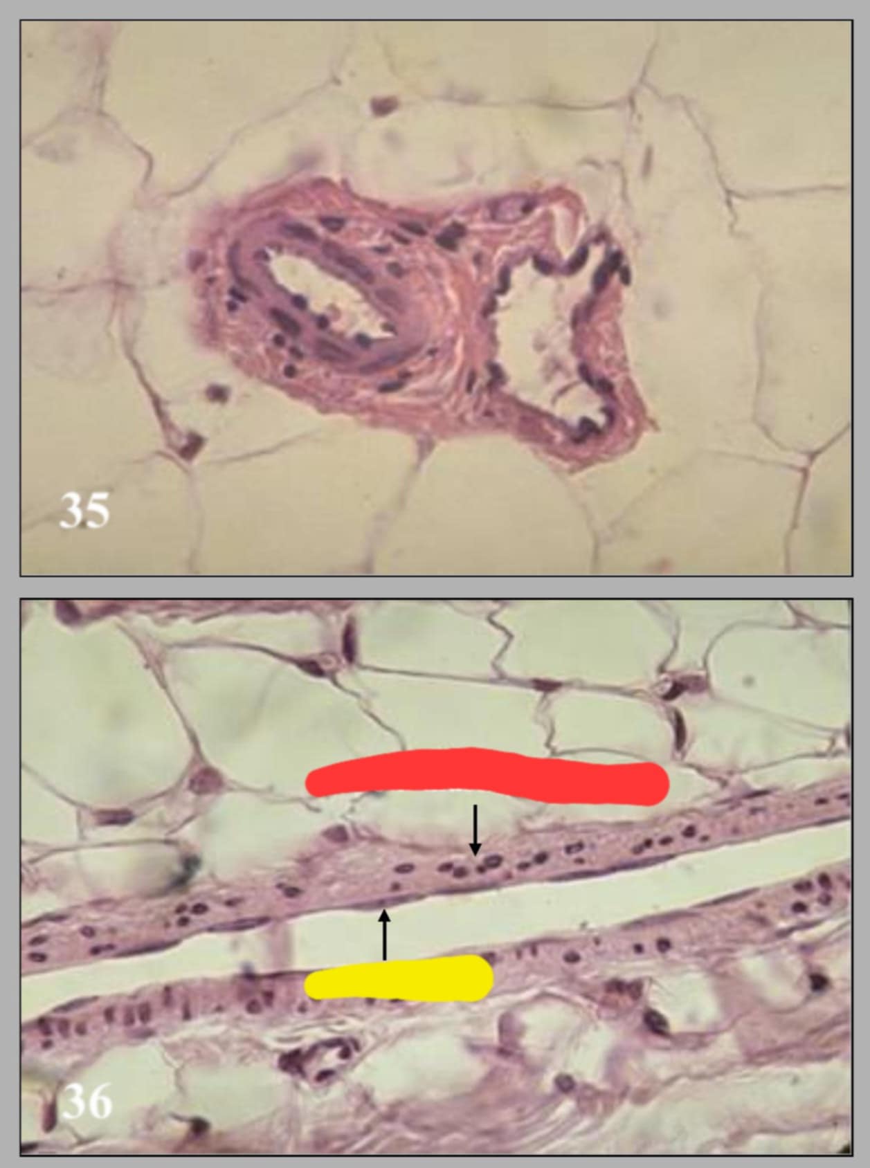 <p>name of these 2 slides and state the parts of the 2nd slide</p>