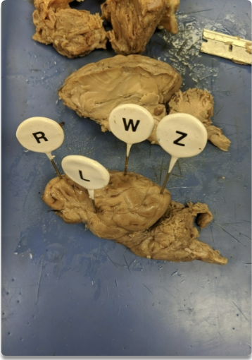 <p>label the structures the pins are pointing to.</p>