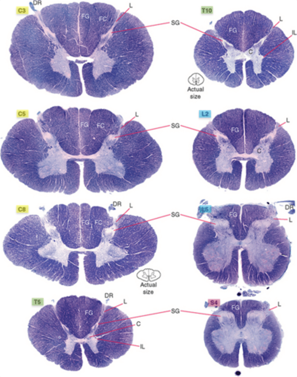 <p>1. cervical</p><p>2. thoracic</p><p>3. lumbar</p><p>4. sacral</p>