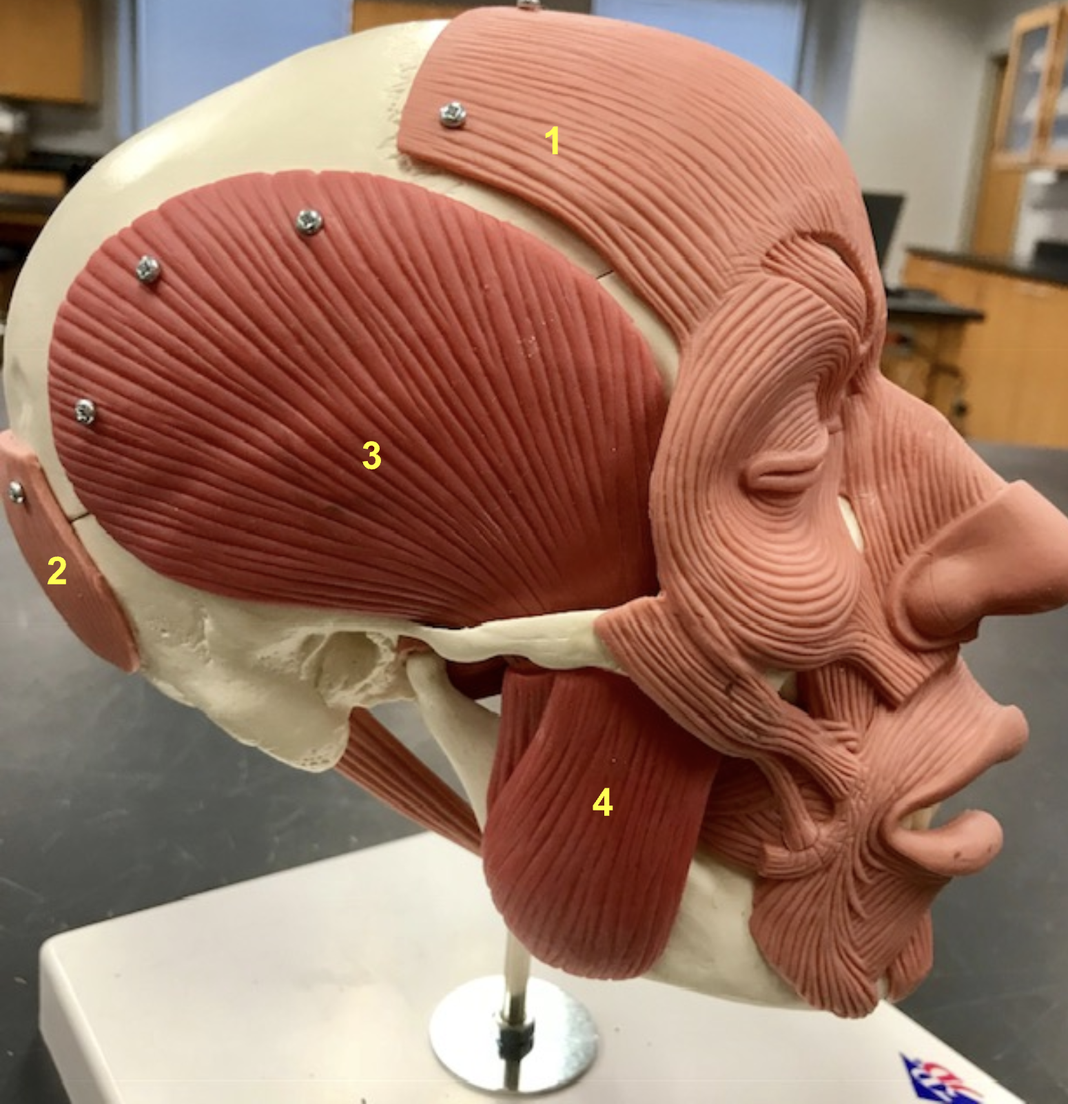 <p>Identify the structure, function, origin, and insertion of #4 (synergist to temporalis)</p>