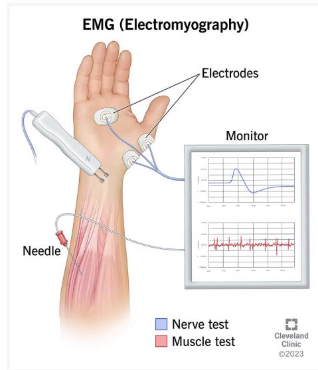 <p>Electromyography (EMG)</p>