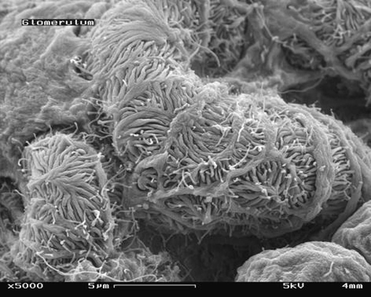 <p>Network of capillaries for blood filtration.</p>