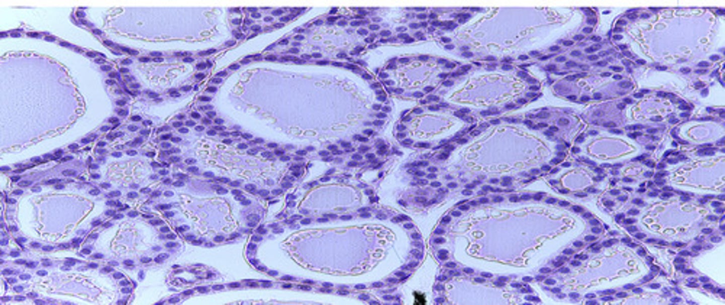 <p>Thyroid gland</p>