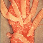 <p>Identify this parasite</p>