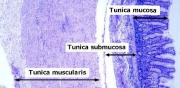 <p><span style="color: green"><strong><mark data-color="green" style="background-color: green; color: inherit">Histology of Large Intestine:</mark></strong></span><strong> </strong><span style="color: red"><strong>Tunica Mucosa </strong></span></p><ul><li><p>Epithelium </p><ul><li><p>Type of glands</p></li><li><p>Type of lining </p></li><li><p>Type of cells </p></li></ul></li><li><p>Lamina propria </p><ul><li><p>Consist of </p></li></ul></li><li><p>Muscularis mucosae </p><ul><li><p>Location </p></li><li><p>Function</p></li></ul></li></ul><p></p>