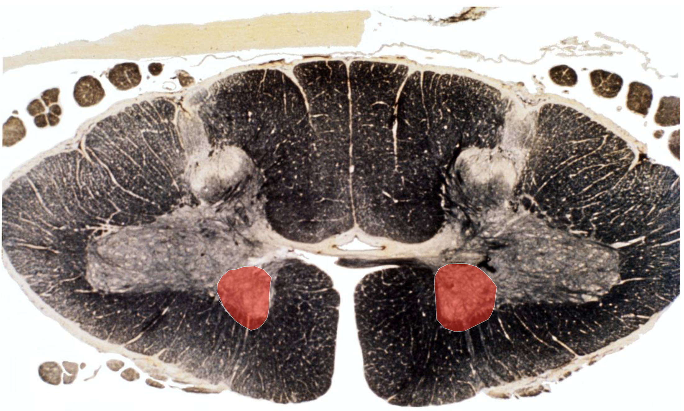 <p>The Medial Motor Nucleus </p><p></p><p>Innervates Muscles of the Axial Skeleton</p>