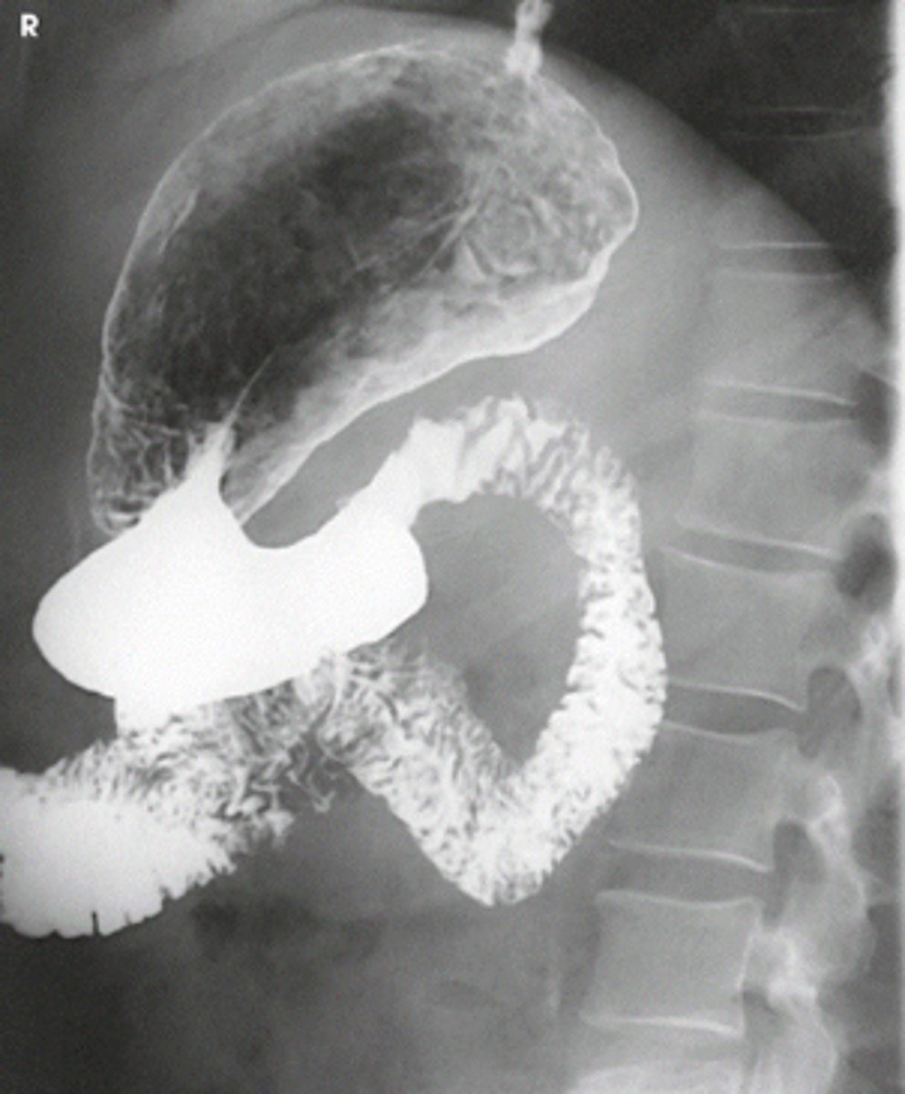 <p>Identify the position the patient is in for the following image.</p>