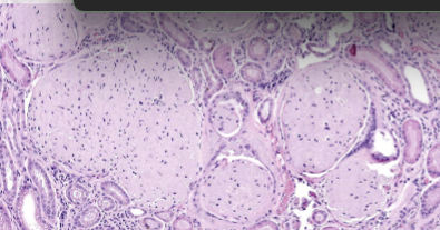 <p>What is the stain for amyloid? </p>