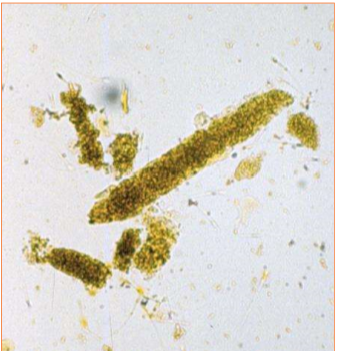 <p>What type of cast is pictured?</p>