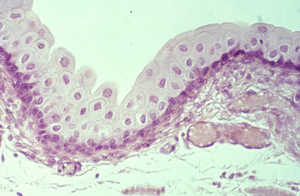 <p>What type of epithelium is this? </p>