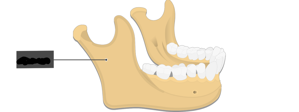 <p>an angled projection of a bone</p>