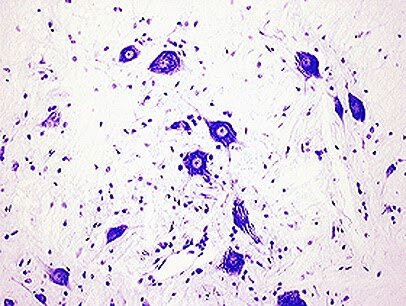 <p>stains nissl, or the rough ER of a cell - gives cytoplasm a mottled appearance</p><ul><li><p>useful for distinguishing neurons and glia from one another, study arrangement of neurons</p></li><li><p>detail of the neurons is not captured</p></li></ul><p></p>