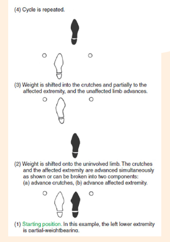 <p>What kind of gait pattern<br>Partial WB modification</p>