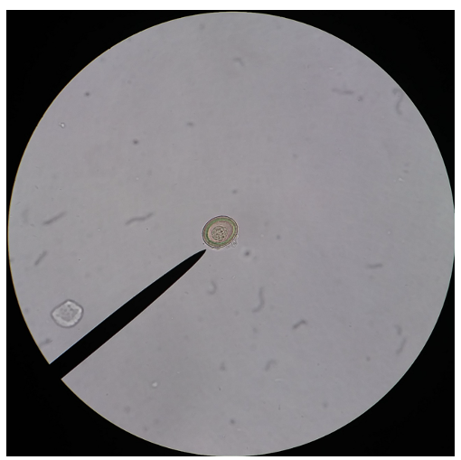<p>What 2 problems occur because of this species?</p>