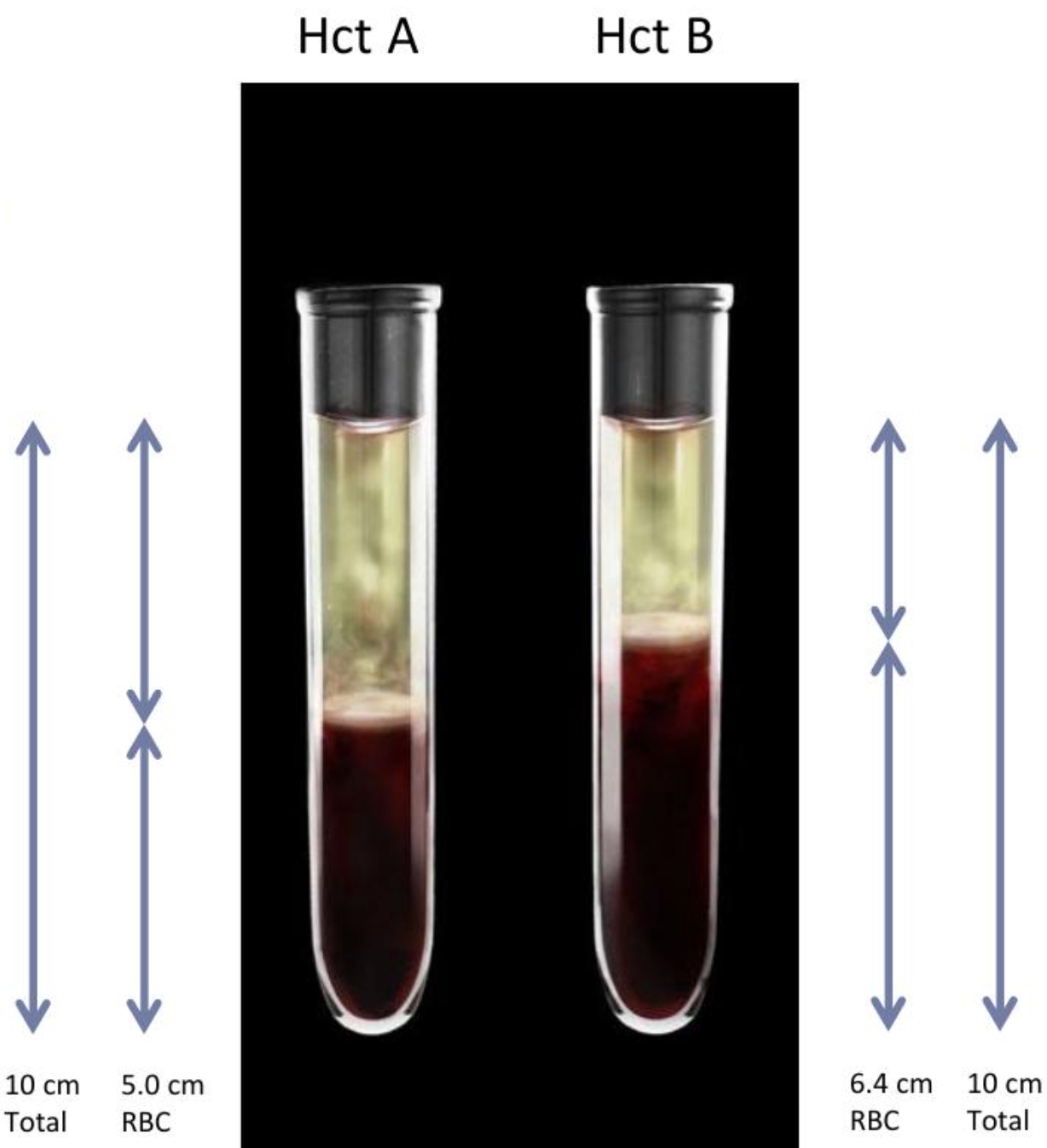 what is the value for hematocrit (HCT) B?