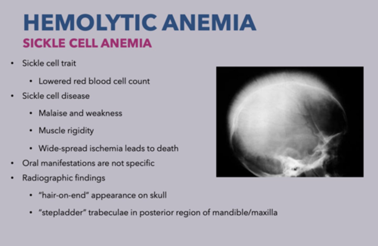 <p>sickle cell disease</p>