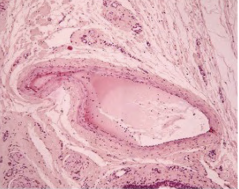 <p>Outline the structre of the vein</p>