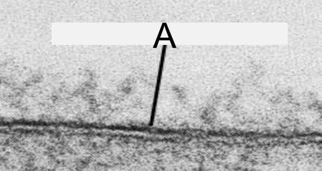 <p>LETTER “A” REPRESENTS: </p>