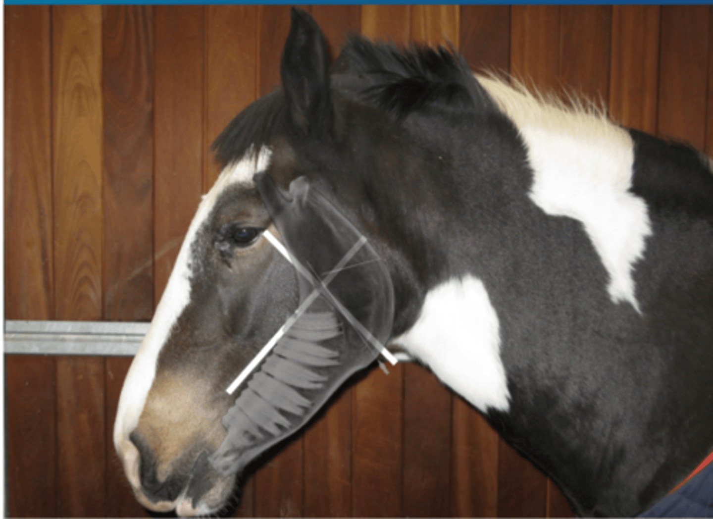 <p>-mandibular branch at mandibular foramen (triangulate to get far in)</p><p></p>