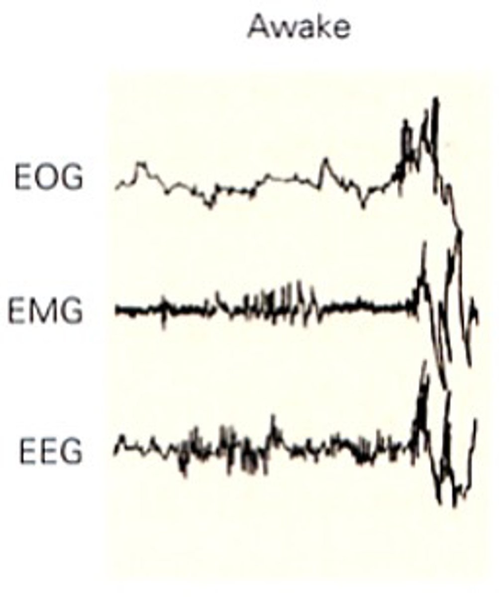 <p>Awake people show ____ voltage EEG activity (10-30μV@16-25Hz)</p><p>As they relax - _____________ (alpha) activity 20-40μV@Hz</p>