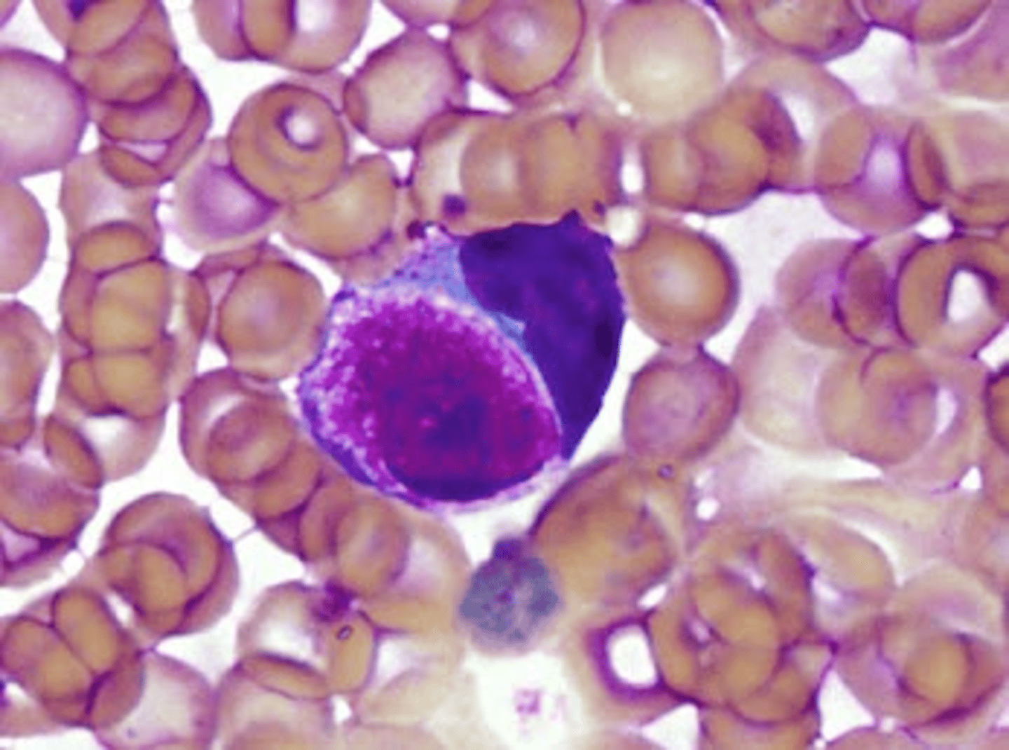 <p>Peripheral blood smear from a guinea pig. What is the nucleated cell in the center of the image, what hormone is it influenced by, and what is it analogous to in other species?</p><p>A. Hofbauer cells, progesterone, plasma cells</p><p>B. Foa-Kurloff cell, testosterone, CD4 lymphocyte</p><p>C. Kupfer cells, corticosterone, heterophil</p><p>D. Foa-Kurloff cell, estradiol, Natural Killer cells</p>