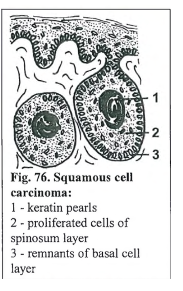 <p>squamous cell carcinoma (horse)</p>