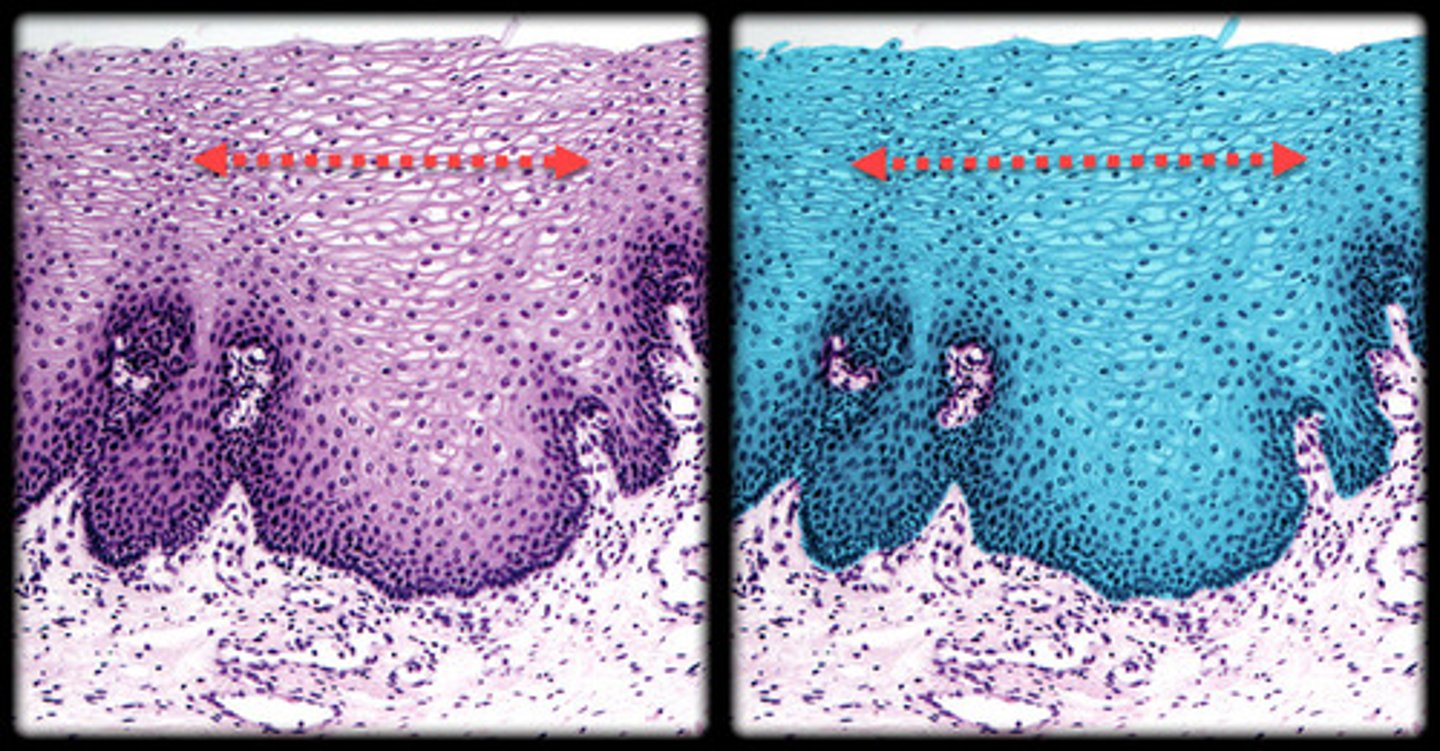 <p>- Multiple layers of cells, with the outermost cells being flat.</p><p>- Deeper layers appear more cuboidal or columnar.</p><p>- Top layer looks thin and flat, while underlying cells become rounder toward the basement membrane.</p><p>- Found in the skin, mouth, and esophagus, offering protection.</p>