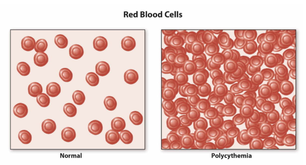 <p><strong>blood doping</strong></p><ul><li><p>_______ EPO</p></li><li><p>transfusions</p><ul><li><p>homologous</p></li><li><p>autologous</p></li></ul></li><li><p>natural blood doping</p></li><li><p>______ risk</p><ul><li><p>spontaneous clotting</p></li></ul></li></ul><p></p>