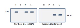 <p>Interpret these results  (heart (H), pancreas (P), kidney (K), and liver (L))</p>