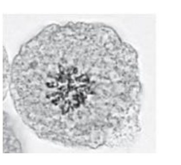 <p>what is this phase of mitosis</p>