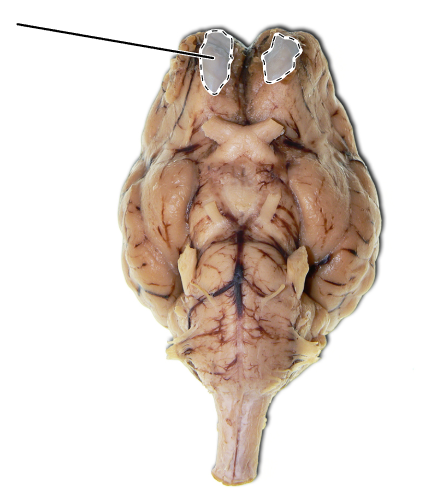 <p>Name the part of the brain that is highlighted.</p>