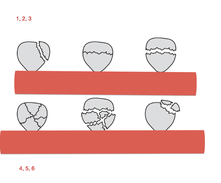 <p>Patellar Fx:</p><ul><li><p>What type of Patellar Fx are these? </p></li></ul><p></p>