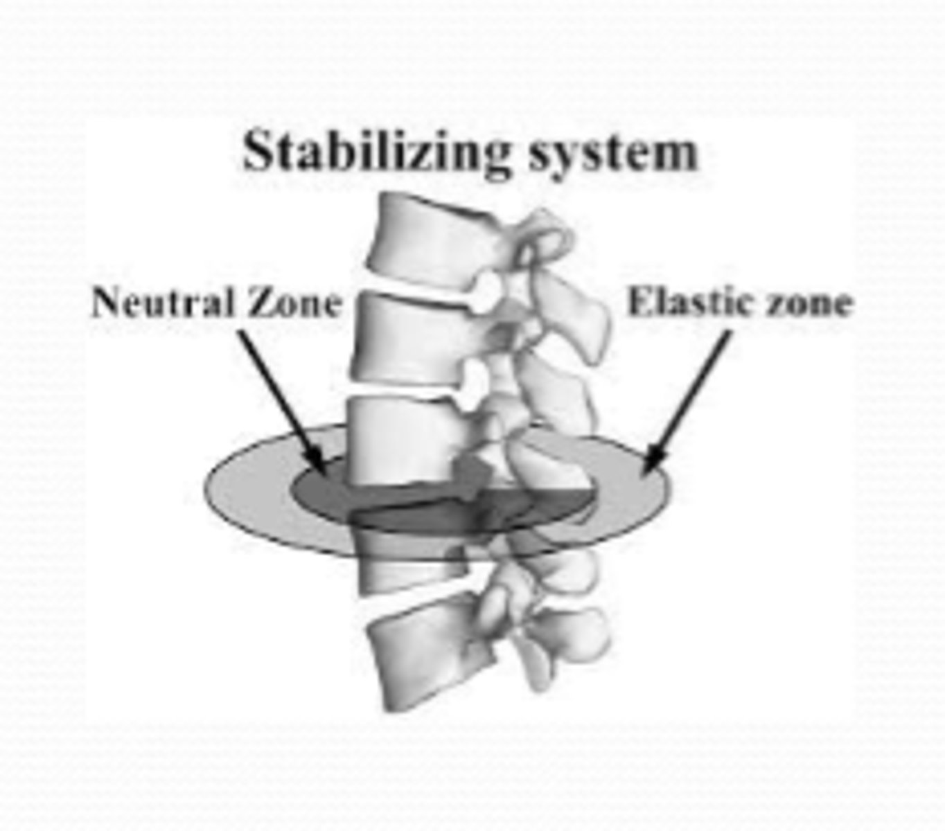 <p>A large neutral zone means greater ___________________.</p><p>HINT: no tension is generated</p>