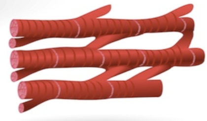 <p>What type of muscle is this? </p>