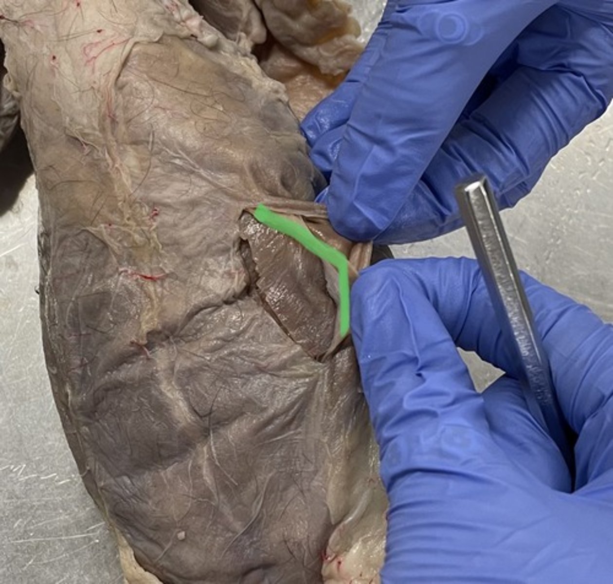 <p>O: iliac crest of ilium</p><p>I: linea alba; inguinal ligament</p><p>A: flex trunk; compress abdomen</p>
