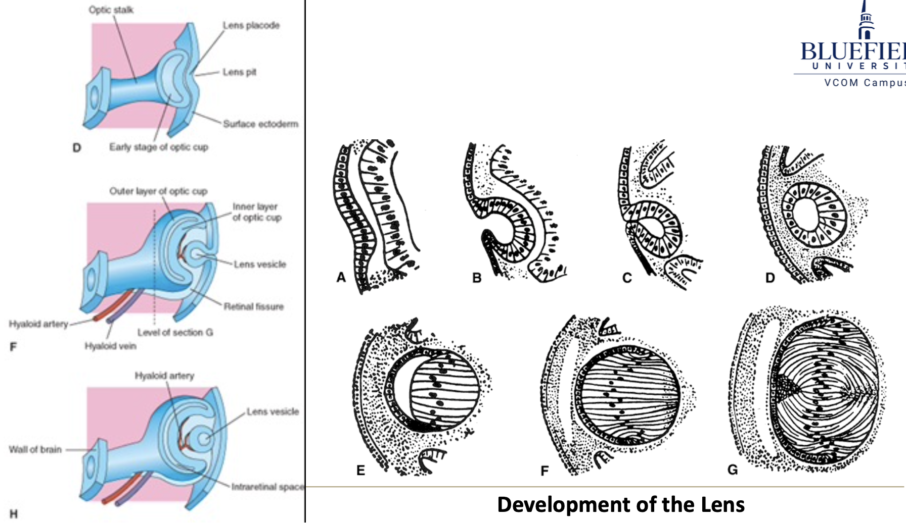 <p>A thickening of the surface ectoderm induced by the retinal disk.</p>