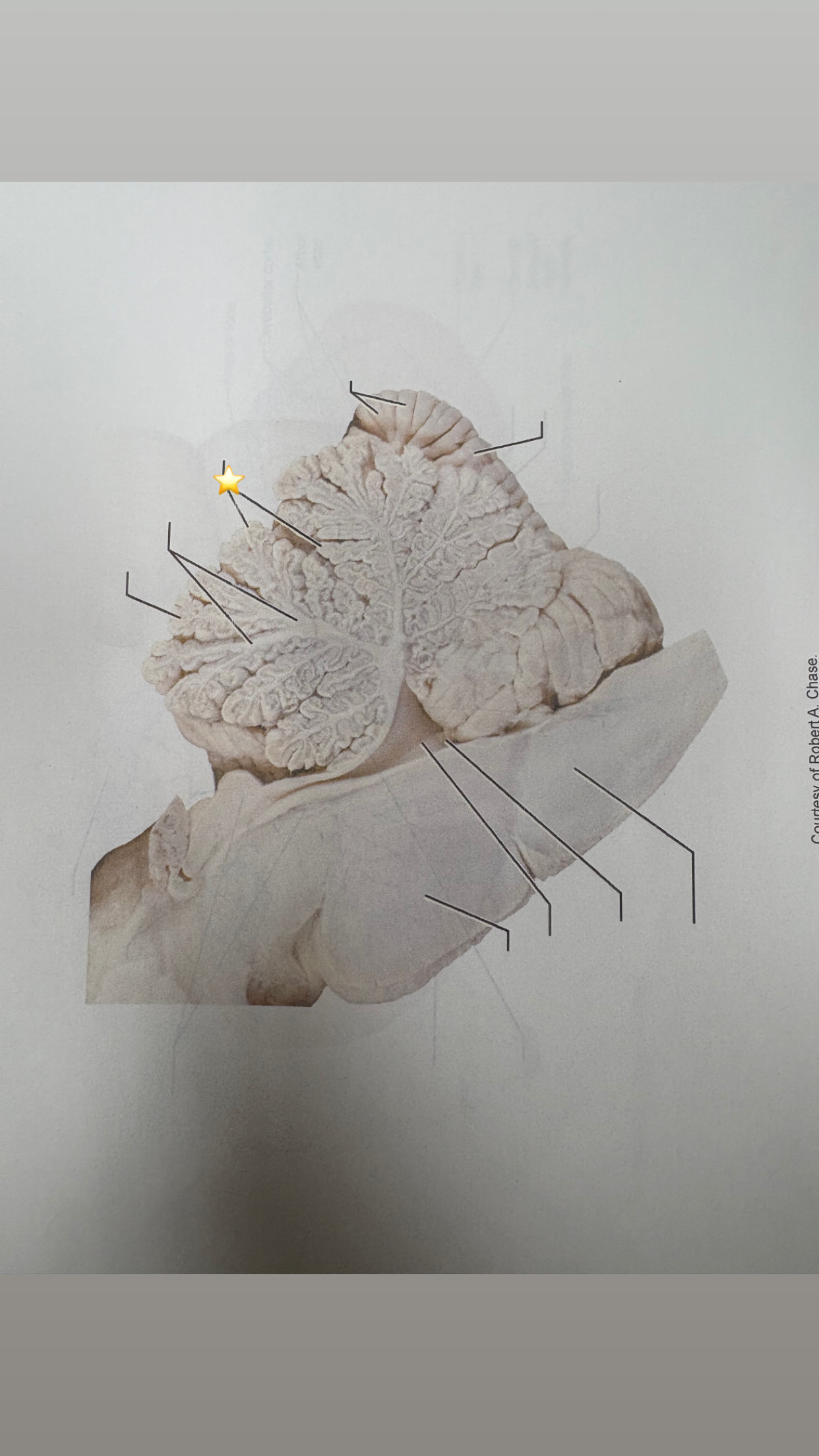 <p>name the starred structure</p>