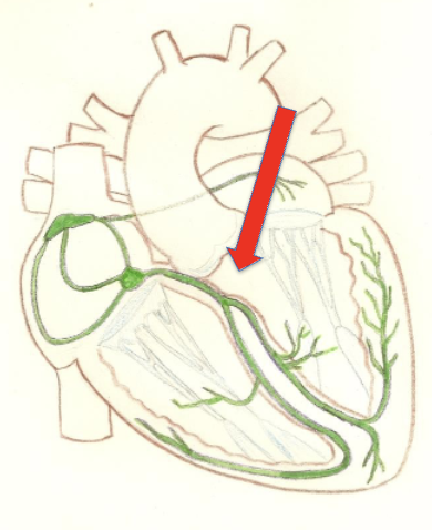 <p>Links atrial conduction to ventricular conduction by receiving signals from the AV node.</p><p>located in the superior portion of the interventricular septum</p>