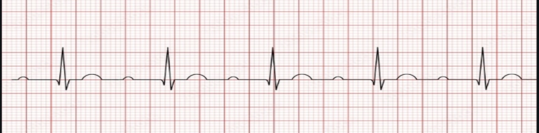 <p>ECG interpretation </p>