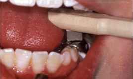 knowt flashcard image