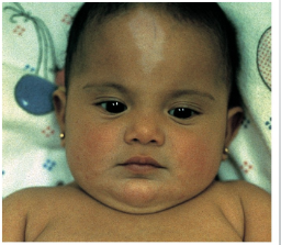 <ul><li><p>last step model organism for drug trial FDA clearance</p></li><li><p>we are a model organism </p></li></ul><p></p>