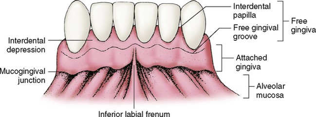 <p>Gingiva that is tightly bound to bone</p>