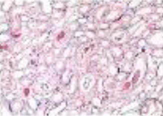 <p>Identifica el tejido</p>