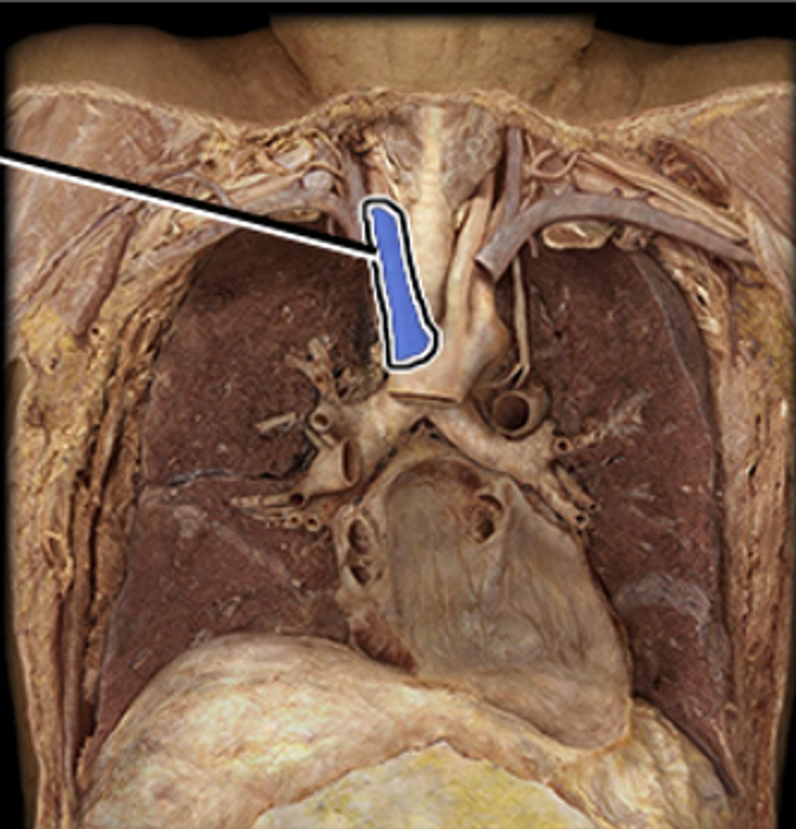 <p>Supplies blood to the right side of the head, neck and upper limb.</p>