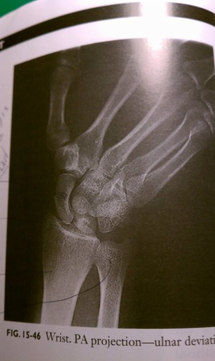 <p>type of joint indicated in image</p>