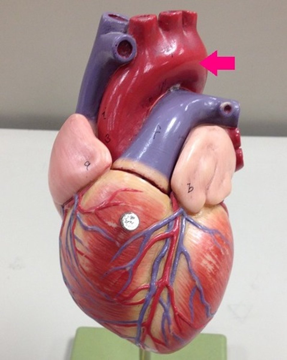 <p>Identify the vessel.</p>