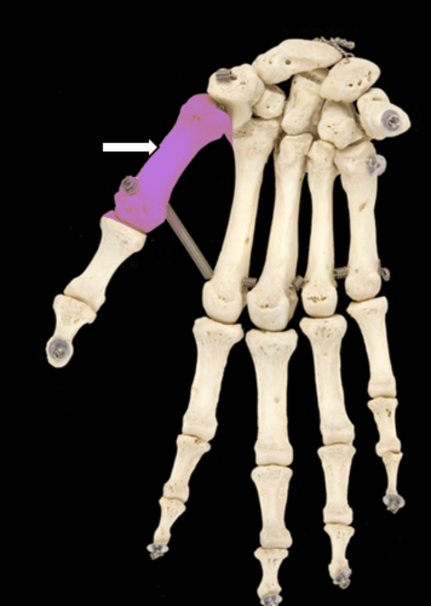<p>name the part</p>