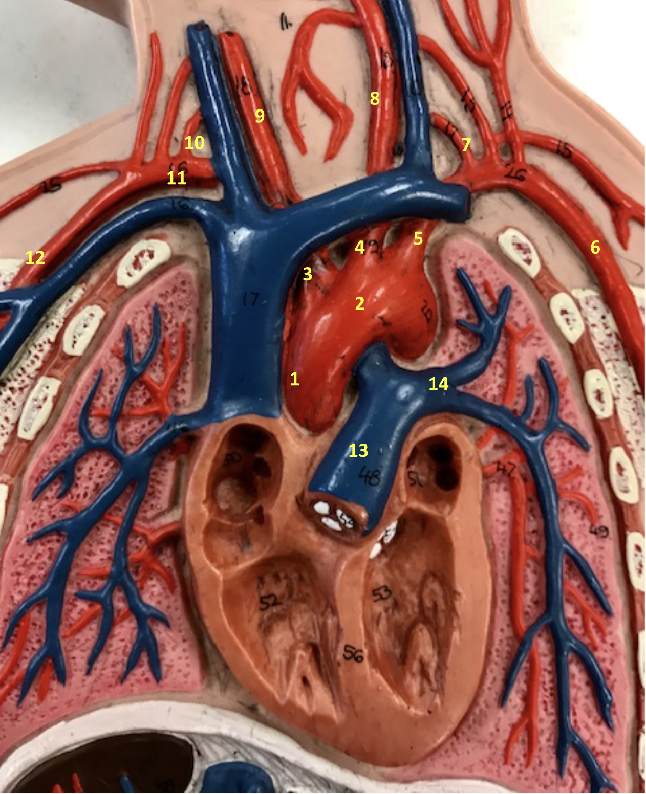 <p>Right subclavian artery (11)</p>