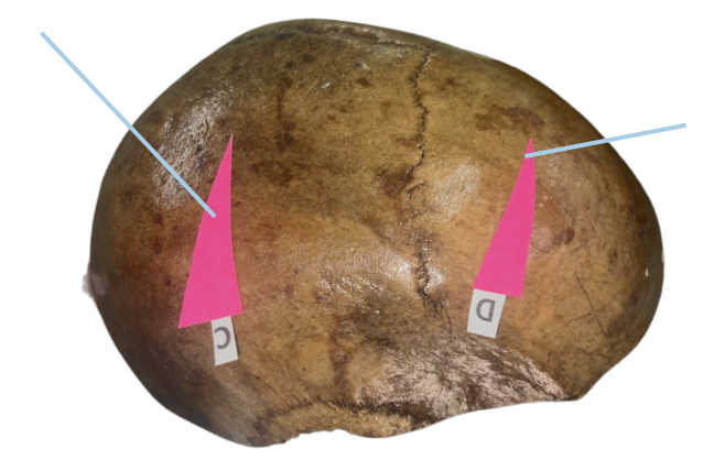 <p>Identify the bone structure labeled as D.</p>