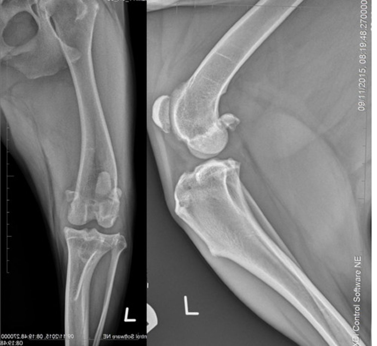 <p>What does this patient have?</p>